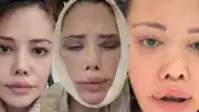 Didem Ceran'ın Ameliyat Süreci ve Hukuki Kararlılığı: "Doktorları İnsan Hakları Mahkemesi’nde dava edeceğim"