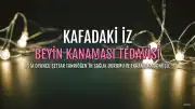 Settar Tanrıöğen'in Kafasındaki İz: Beyin Kanaması Sonrası Oluşan İzlerin Hikayesi
