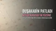 Survivor Şampiyonu Nefise Karatay Evinde Talihsiz Bir Kaza Yaşadı: Duşakabin Yüzüne Patladı
