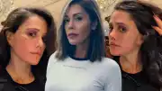 Sosyal Medya Fenomeni D.Ç. Estetik Ameliyatlar Sonrası Yüz Felci Geçirdiğini Duyurdu