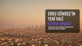 Ebru Gündeş'in Estetik Operasyon Sonrası Yeni Görüntüsü Sosyal Medyada Gündem Oldu