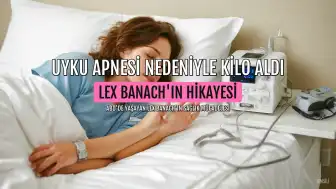 Uyku Apnesi Nedeniyle 6 Ayda 18 Kilo Alan Lex Banach, Tedavi Sonrası 27 Kilo Verdi