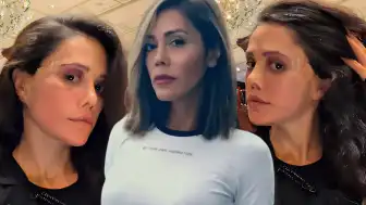 Sosyal Medya Fenomeni D.Ç. Estetik Ameliyatlar Sonrası Yüz Felci Geçirdiğini Duyurdu
