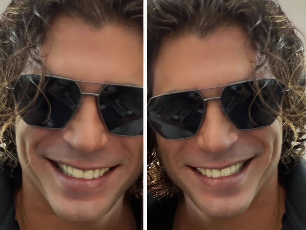 Can Yaman Sakallarını Kestirdi, Yeni Hali Sosyal Medyada Gündem Oldu